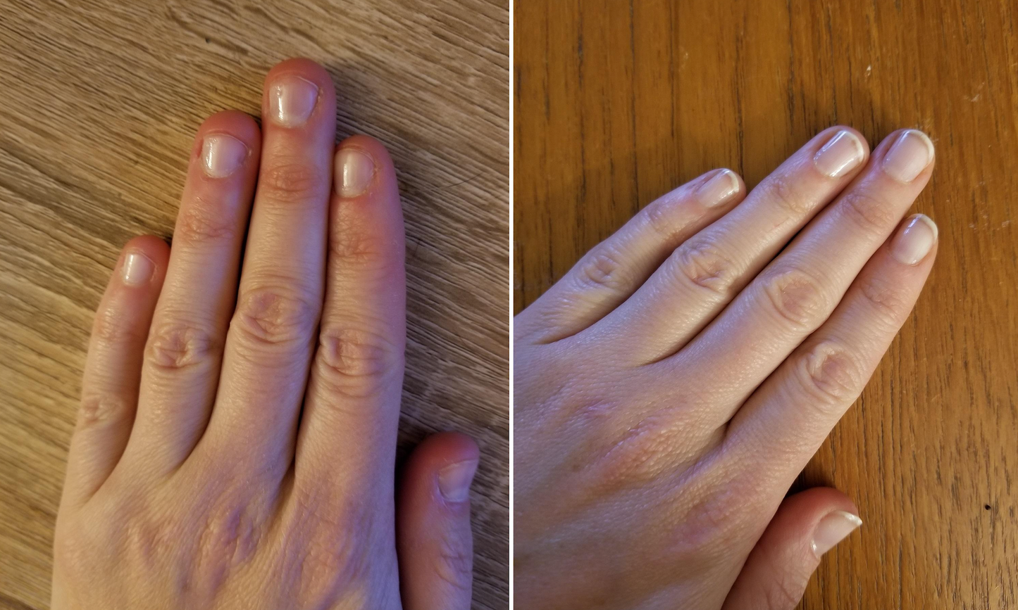 NAIL IT™ – Bitter-Taste Nail Biting Prevention Cream (For Men, Women & Children)