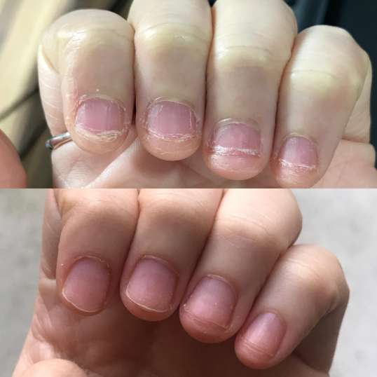 NAIL IT™ – Bitter-Taste Nail Biting Prevention Cream (For Men, Women & Children)